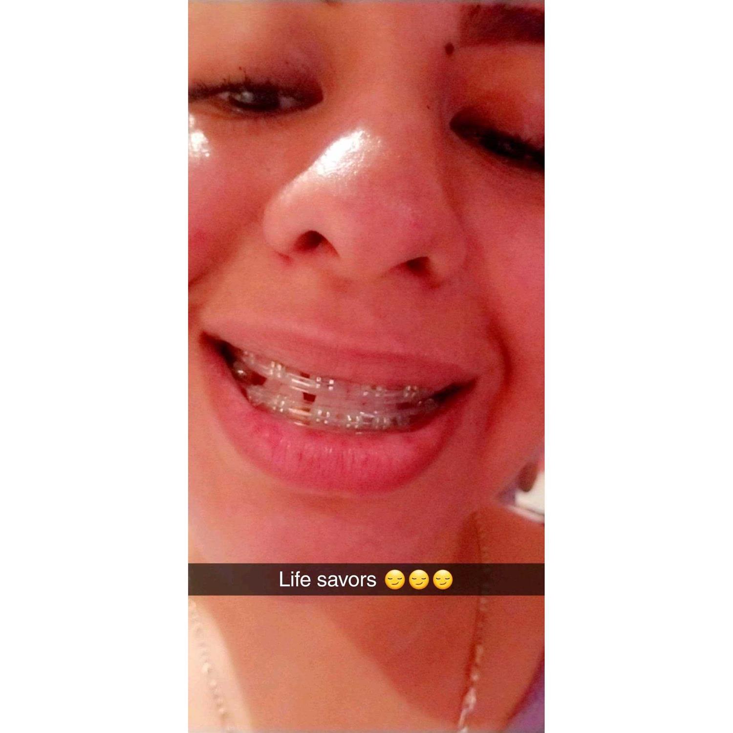 Element Comfort Cover Braces Guard/Lip Mouth Protector - Image 5