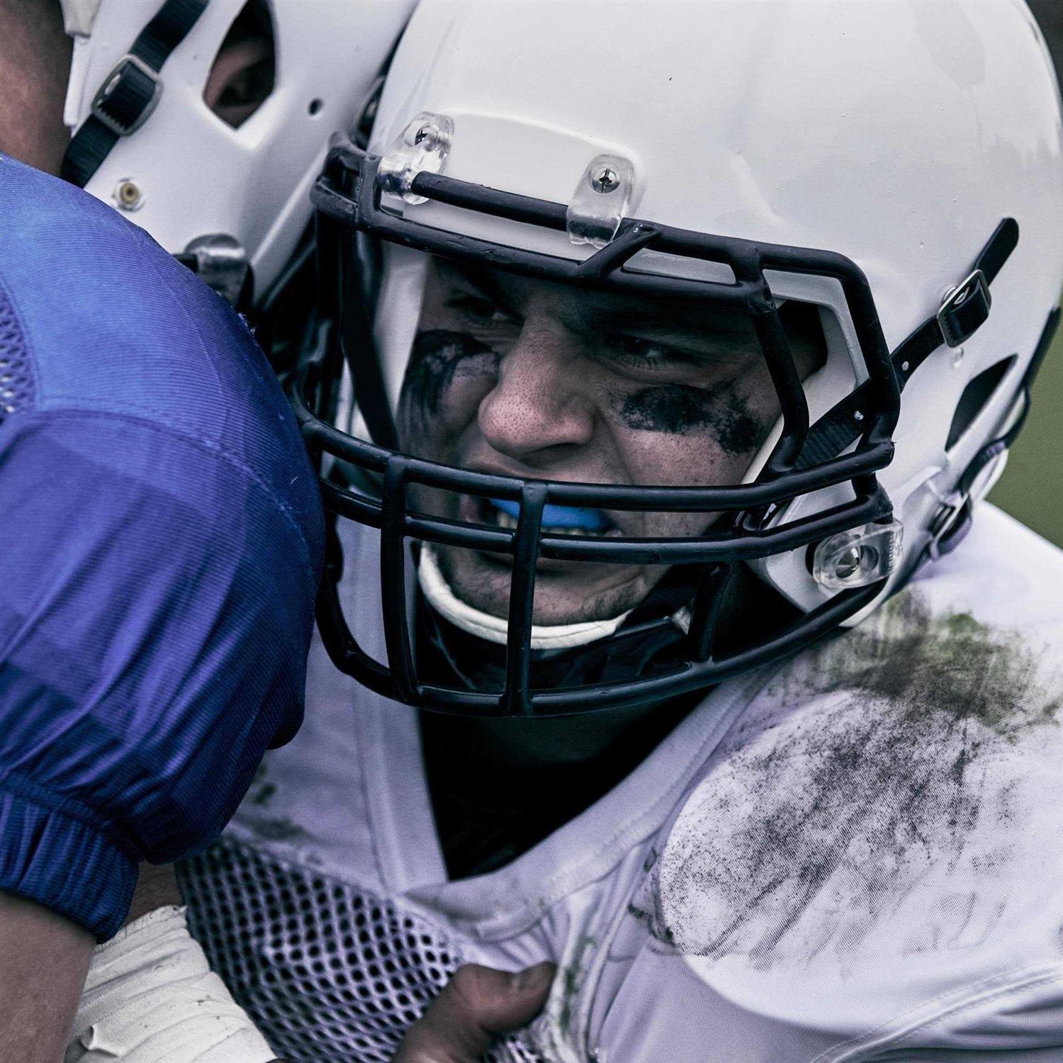 Sisu 3D Custom Fit Mouthguard - Image 4