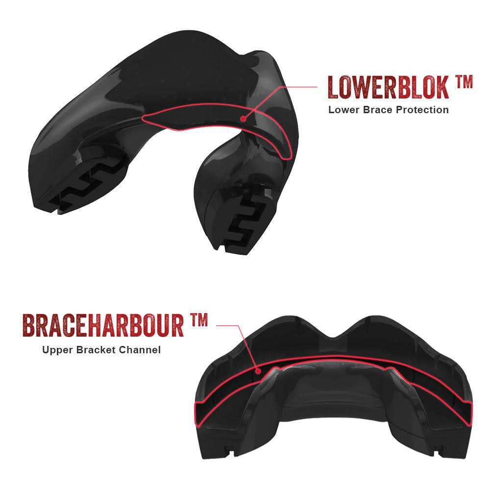 SAFEJAWZ Mouthguard for Braces, One Size Re-Mouldable Mouth Guard with Case for Boxing, Basketball, Football, Mma, Lacrosse, Hockey and All Contact - Image 4